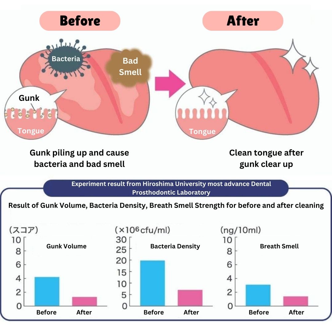 Matsumoto Mold Tsunami Tongue Cleaner